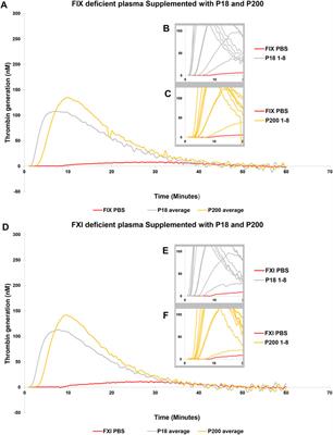 Urinary extracellular vesicles carry multiple activators and regulators of coagulation